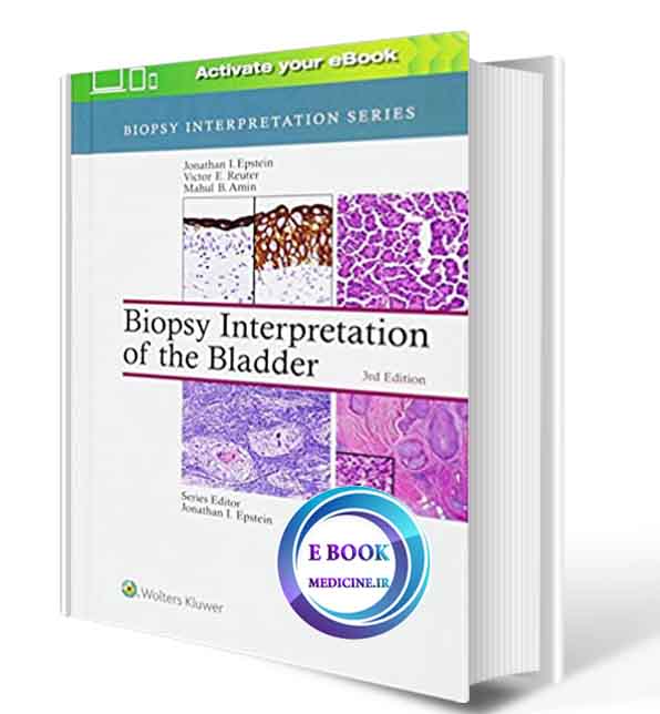 دانلود کتابBiopsy Interpretation of the Bladder 2017 ( PDF)